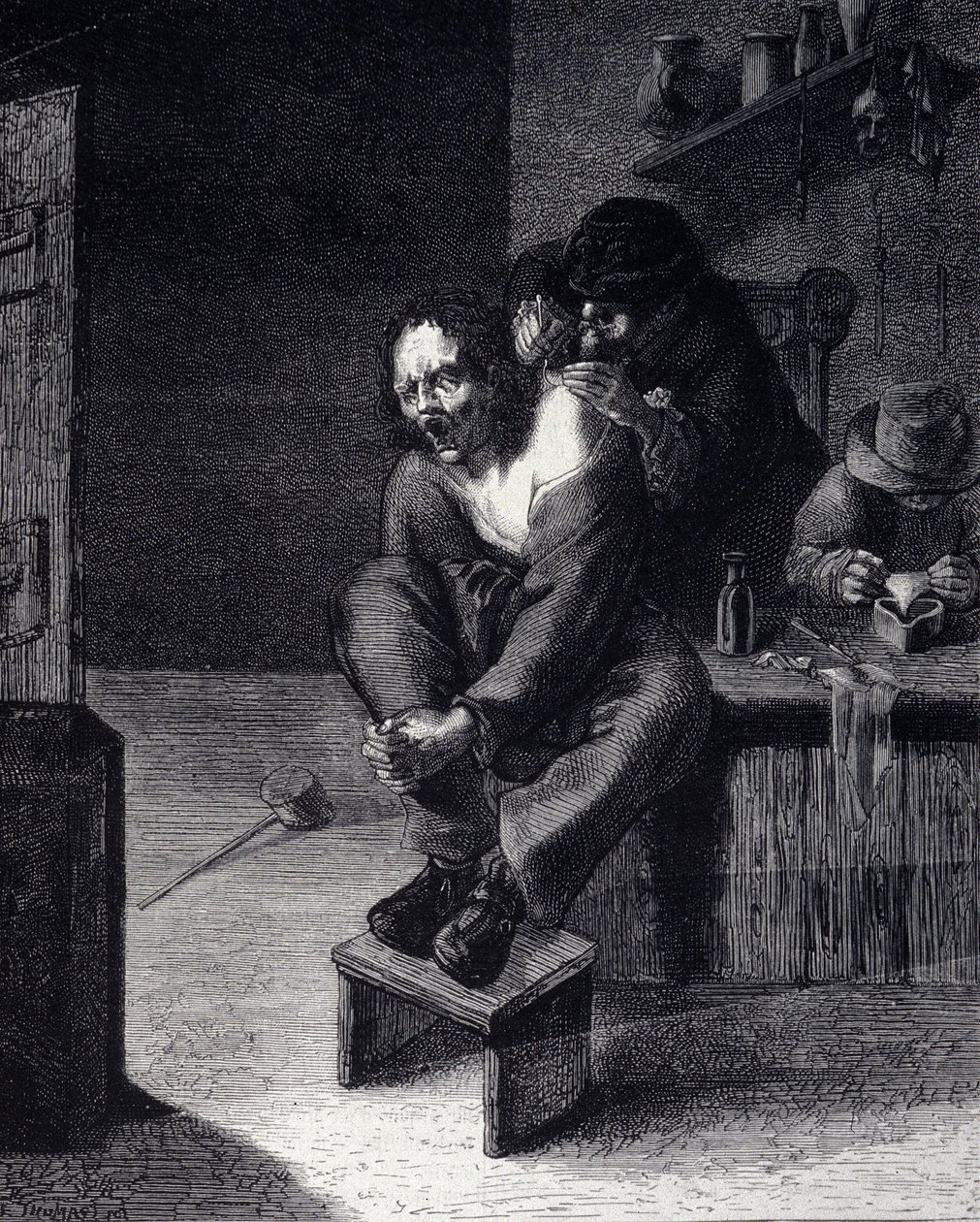 A sebészeti műtét Metszet Adriaen Brouwer festménye után (1608-ban) XVII. alkotó: Adriaen (after) Brouwer