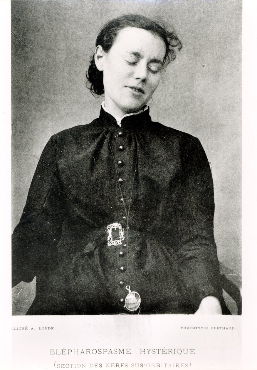 Akaratlan szemgörcs, Jean Martin Charcot (1825-93) professzor "Nouvelle Iconographie de la Salpetriere" című művéből, Párizs, 1889. alkotó: Albert Londe