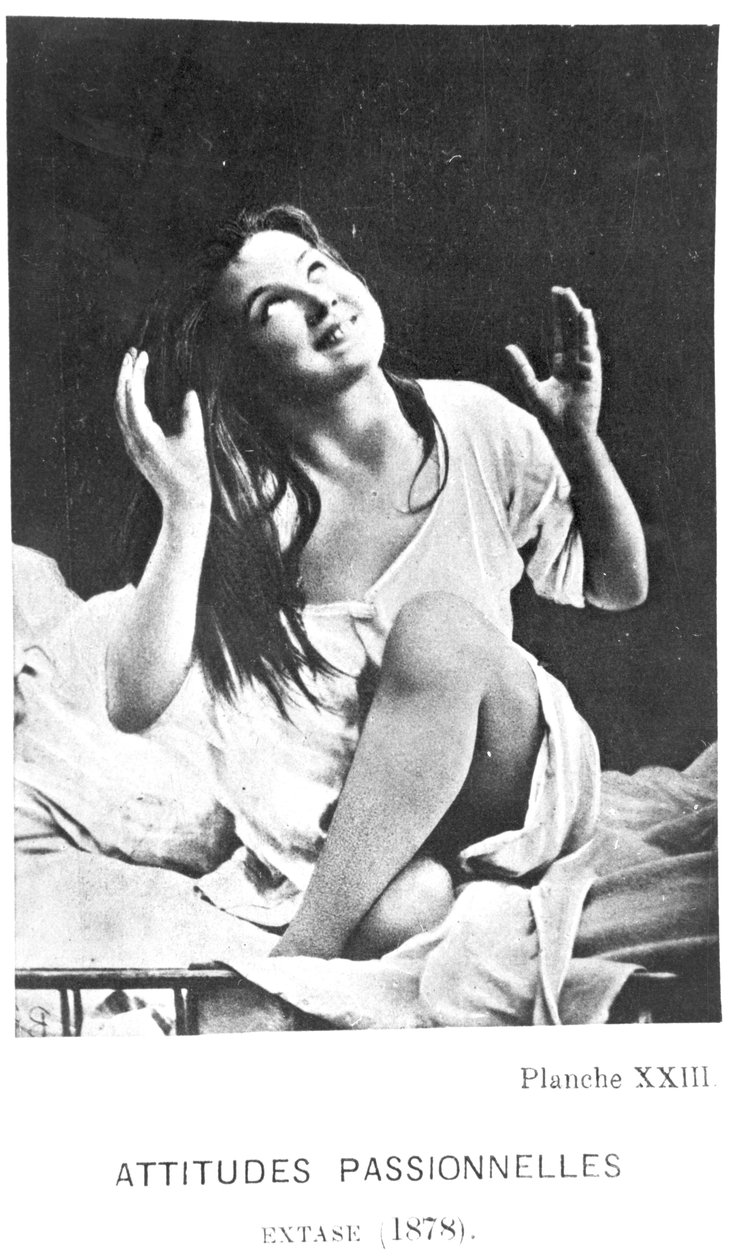 Szenvedélyes attitűdök: Augustine extázisban, Desire Magloire Bourneville (1840-1909) és Paul Regnard (1850-1927) „Iconographie de la Salpetriere” című művéből, 1878 alkotó: Albert Londe
