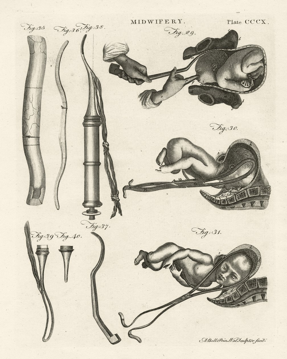 Szülésznő, illusztráció az "Encyclopedia Britannica"-ból, kiadva Edinburgh-ban, 1798 (rézmetszet) alkotó: Alexander Bell