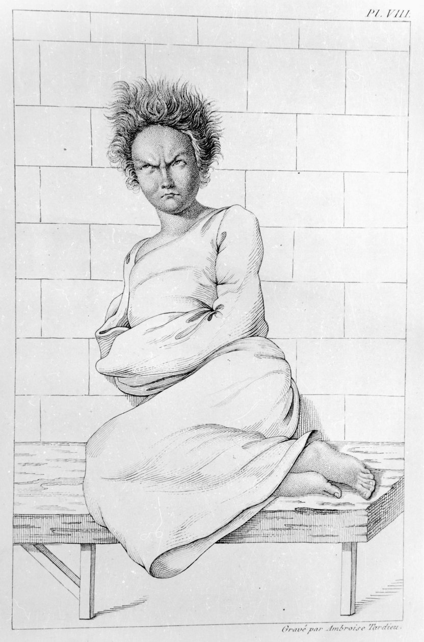 Nő kényszerzubbonyban, illusztráció Etienne Esquirol (1772-1840) "Des Maladies Mentales considerees sous le rapport medical, hygienique et medico-legal" című művéhez, 1838. alkotó: Ambroise Tardieu