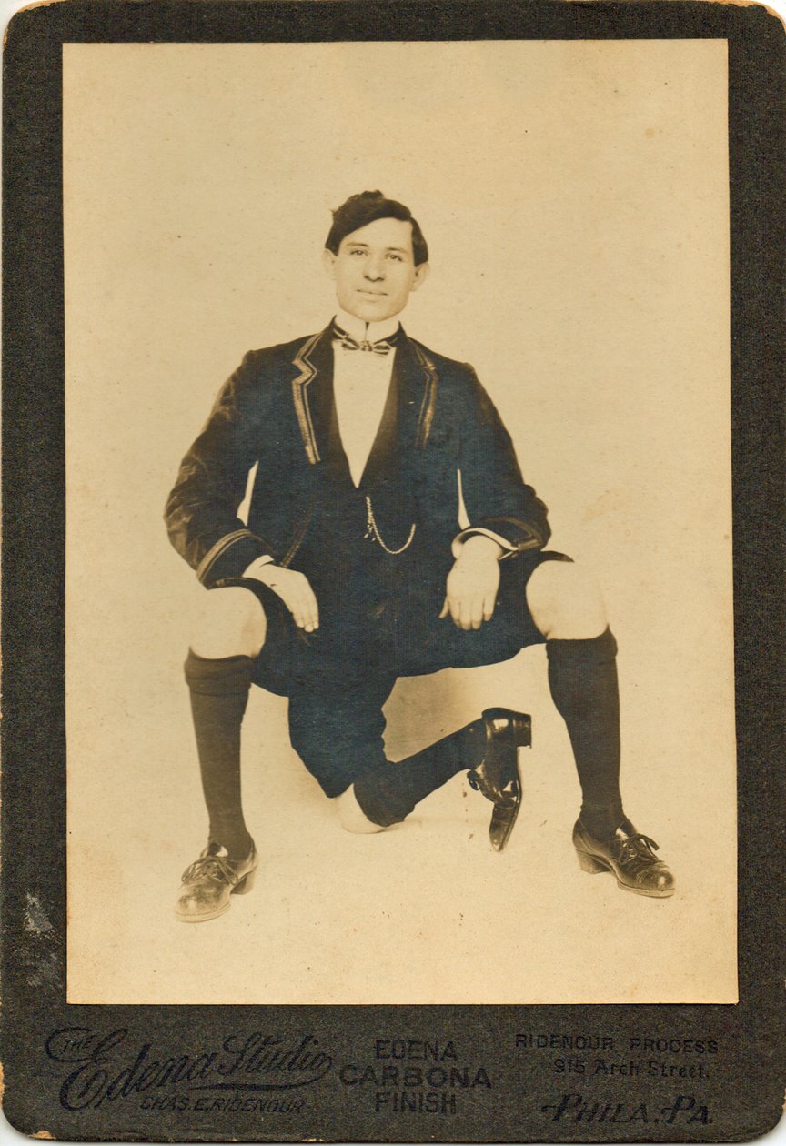 Francisco Lentini (1881-1966), a háromlábú férfi portréja alkotó: American Photographer