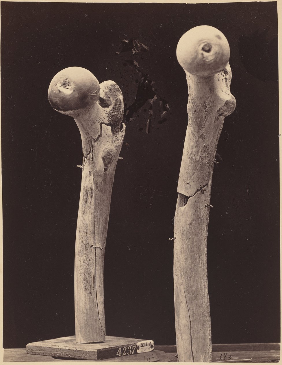 A combcsont lőtt töréseinek mintái,c. 1867 (fénykép) alkotó: American Photographer