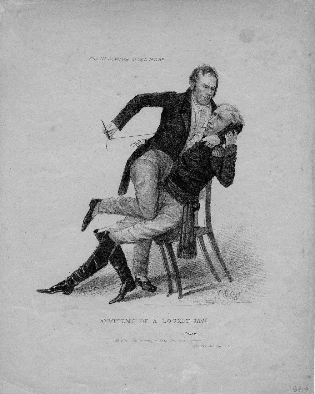 Zárt állkapocs tünetei, 1827 körül alkotó: American School