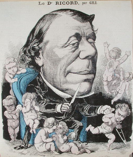 Dr. Philippe Ricord (1800-89) karikatúrája (színes metszet) alkotó: Andre Gill