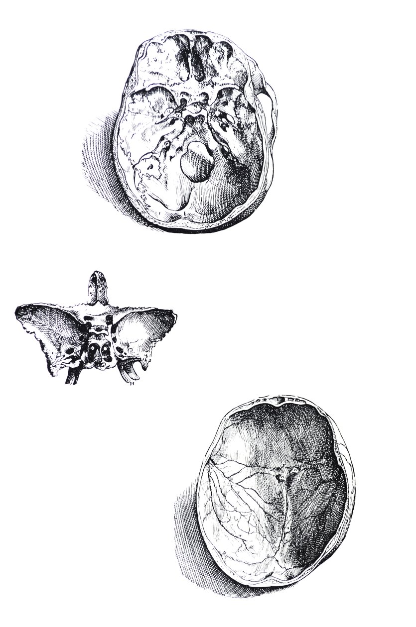 A tányérok a De Humani Corporis Fabrica első könyvéből alkotó: Andreas Vesalius