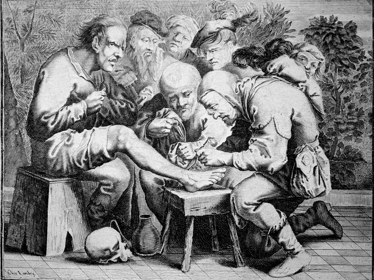 Bokaműtét (gravírozás alkotó: Anonymous Anonymous