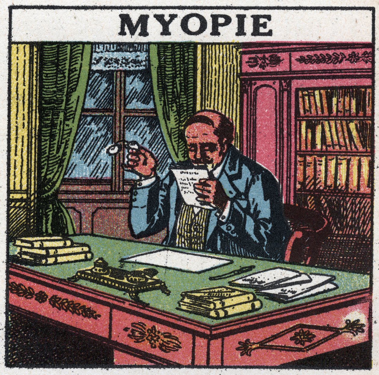 A szem: rövidlátásban szenvedő személy. Névtelen illusztráció 1925-ből. Magángyűjtemény. alkotó: Anonymous Anonymous
