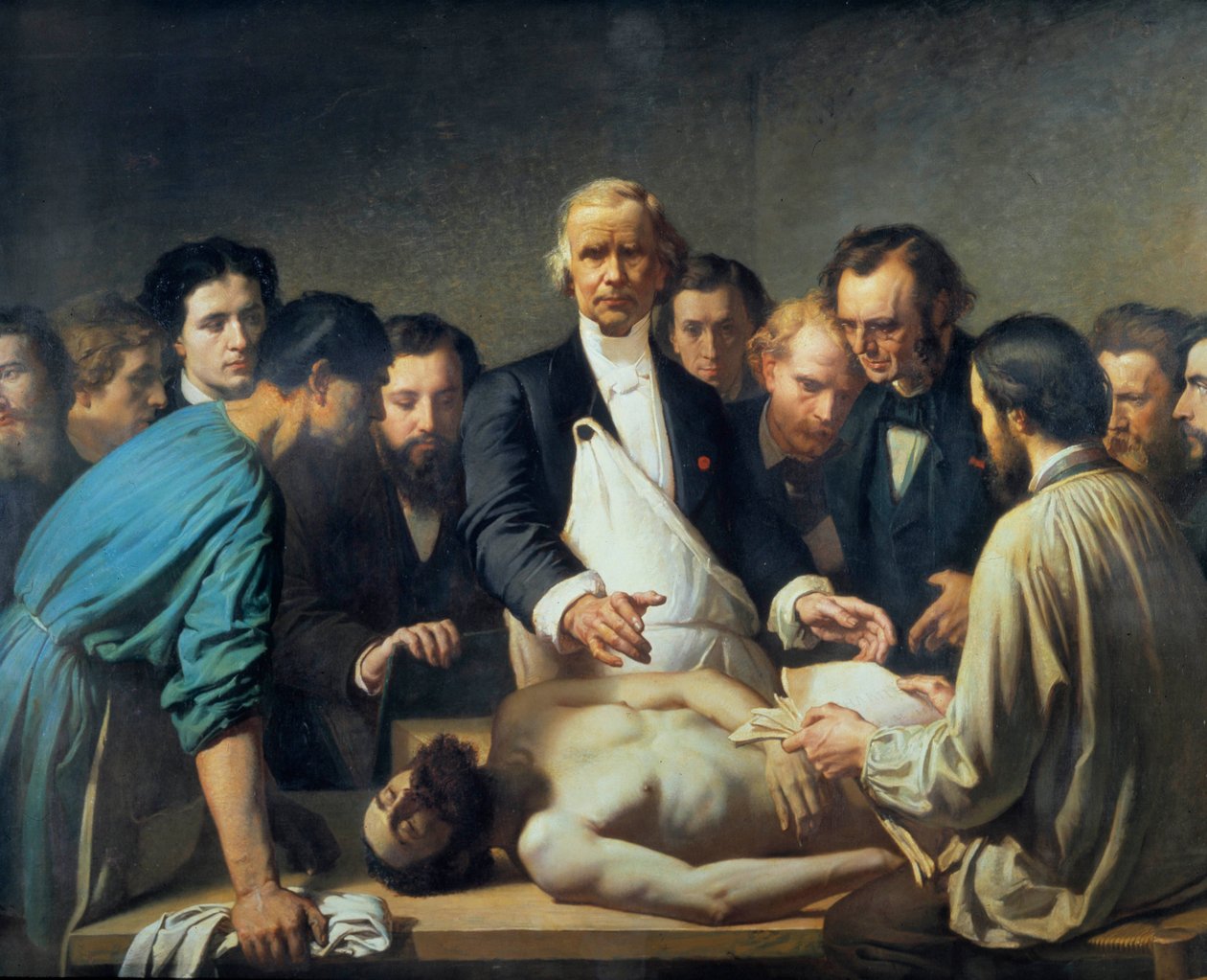 Alfred Velleau doktor (1795-1867) a Charity-nél boncolásra indul. Egy orvost diákjai vesznek körül, akik készek beavatkozni egy holttesten. Francois Feyen Perrin (1826-1888) festménye. 19. század. Tours musee des Beaux Arts – Alfred Velpeau alkotó: Auguste (after) Feyen Perrin