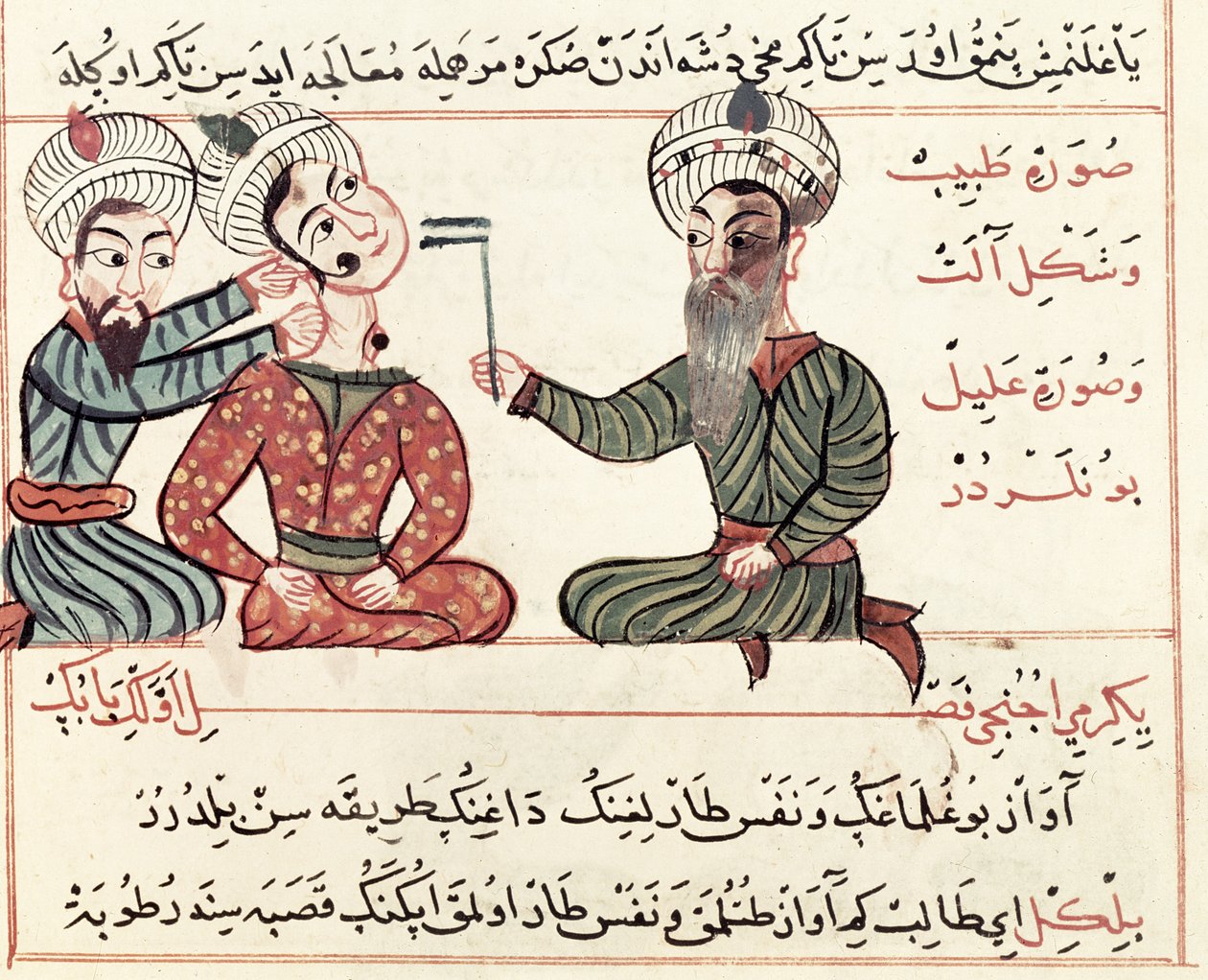 Ms Sup Turc 693 fol.29v Scrofula kiégetése, 1466 alkotó: Charaf ed Din