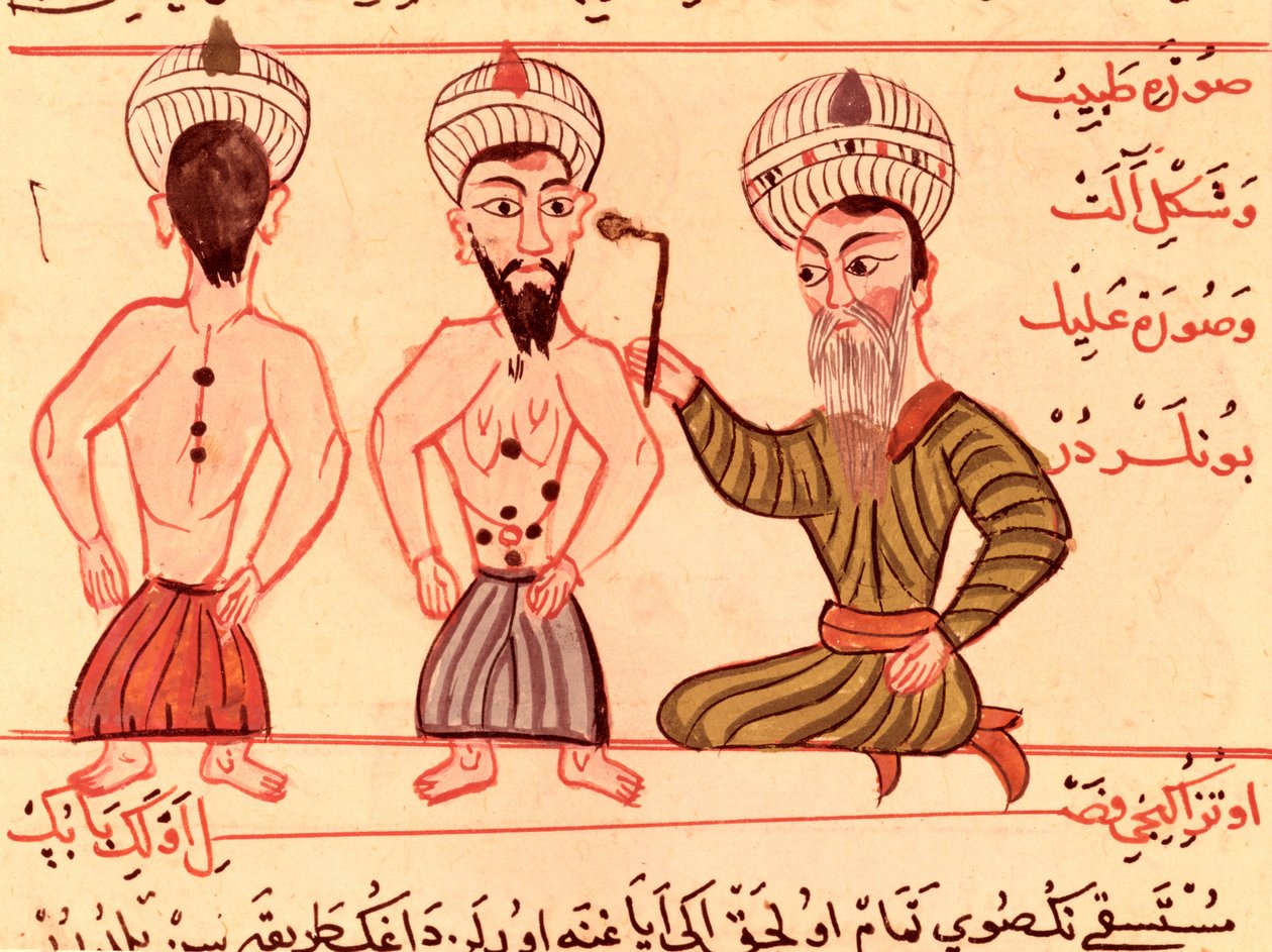 Sup Turc 693 fol.35 Kauterizációs műtét, 1466 alkotó: Charaf ed Din