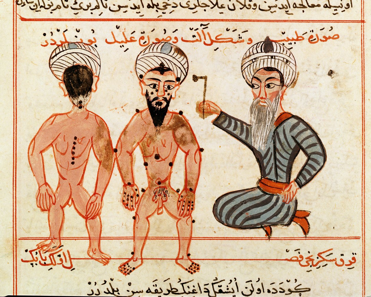 Ms Sup Turc 693 fol.46v Lepra elváltozások kauterizálása, 1466 alkotó: Charaf ed Din