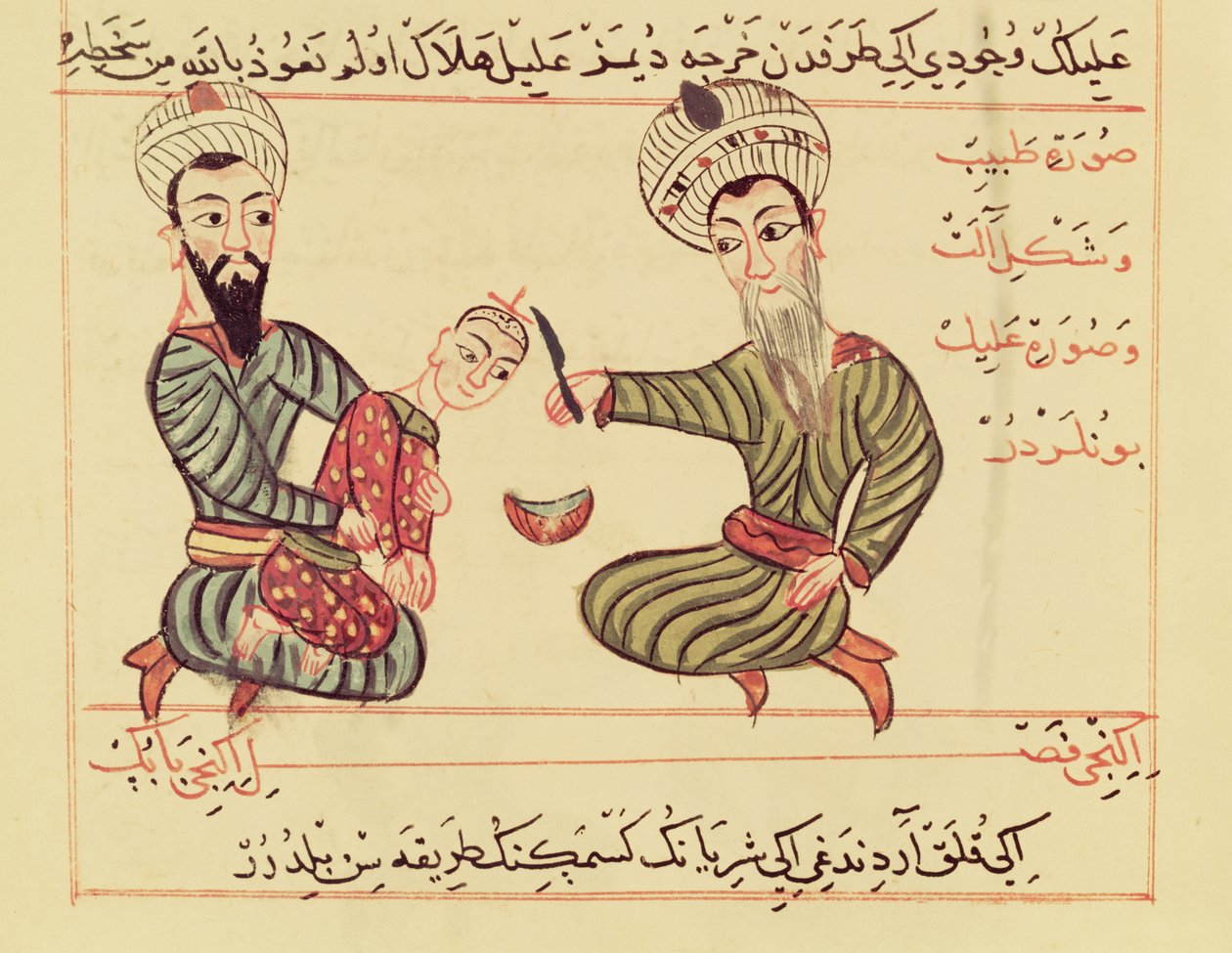 Ms Sup Turc 693 fol.53 Felgyülemlett folyadék kiürítése a gyermek fejéből,1466 alkotó: Charaf ed Din