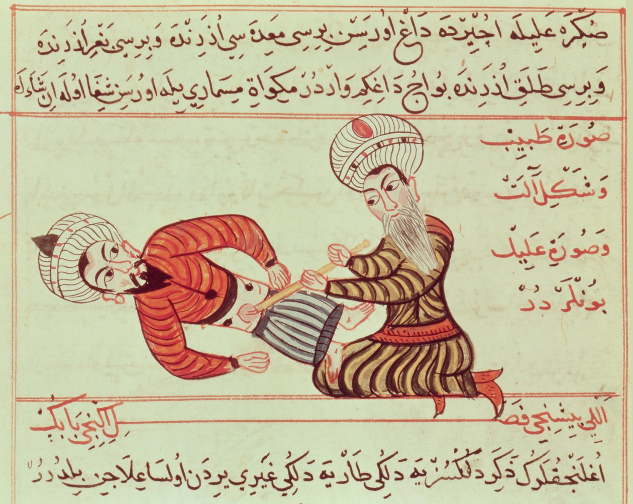Ms Sup Turc 693 fol.95 A hasüreg sebészeti punkciója a peritoneális folyadék leszívása kanüllel vízkórban szenvedő betegen, 1466 alkotó: Charaf ed Din
