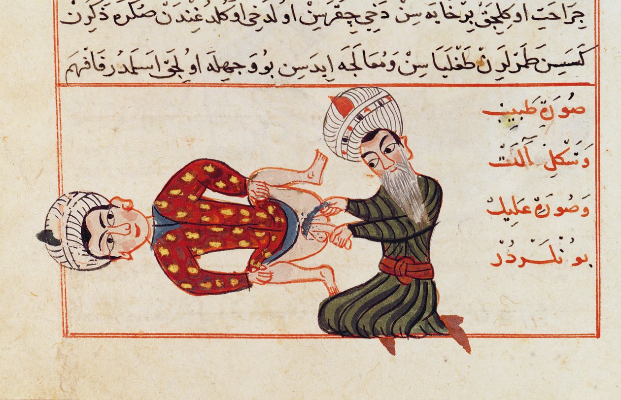 Ms Sup Turc 693 fol.76v Kasztrációs műtét, 1466 alkotó: Charaf ed Din