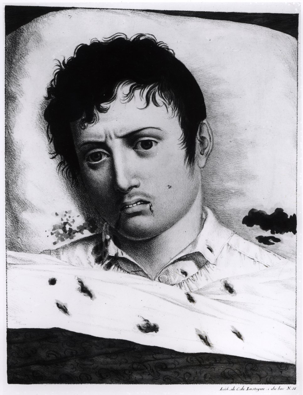 A sárgaláz megfigyelése, 1819 körül alkotó: Charles Lasteyrie du Saillant