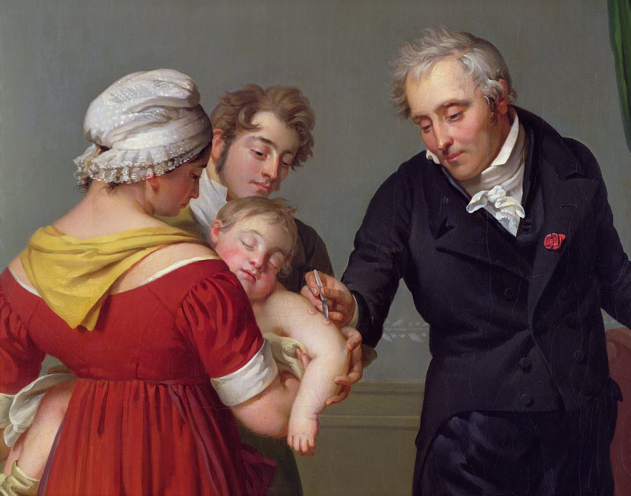 Jean Louis Alibert báró (1768-1837) a himlő elleni oltást végezte a Liancourt-i kastélyban, kb. 1820 (részlet) alkotó: Constant Joseph Desbordes