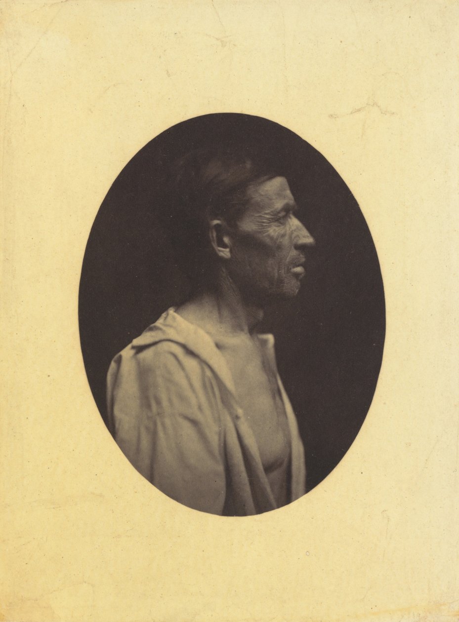 Egy 42 éves, alkoholfogyasztástól elkábított férfi profilképe..., 1854-1856. alkotó: Duchenne de Boulogne