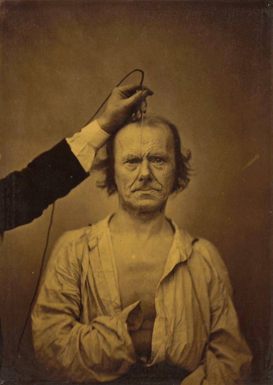 Figyelem balra, súlyosság, agresszió jobb, 1854-1856, nyomtatva 1862. alkotó: Duchenne de Boulogne