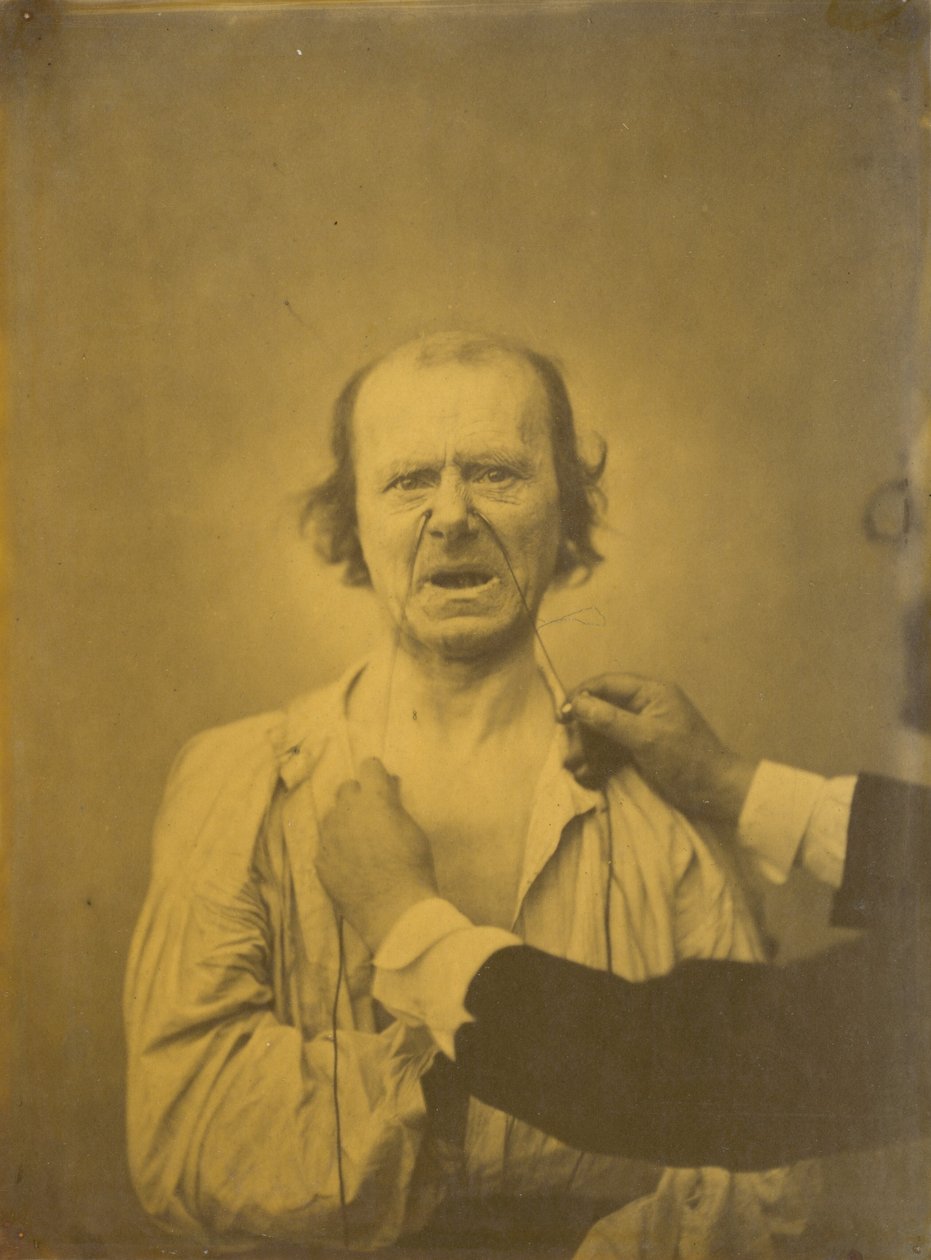 Elégedetlenség, rossz humor, 1854-1856, nyomtatva 1862. alkotó: Duchenne de Boulogne