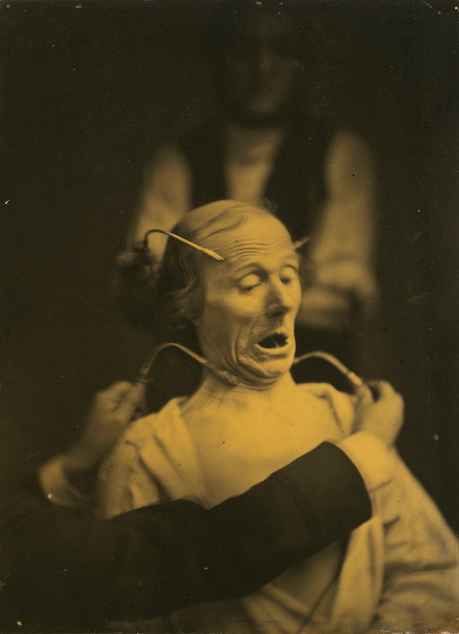 A rémület kifejezése, 1854-1856, nyomtatva 1862. alkotó: Duchenne de Boulogne