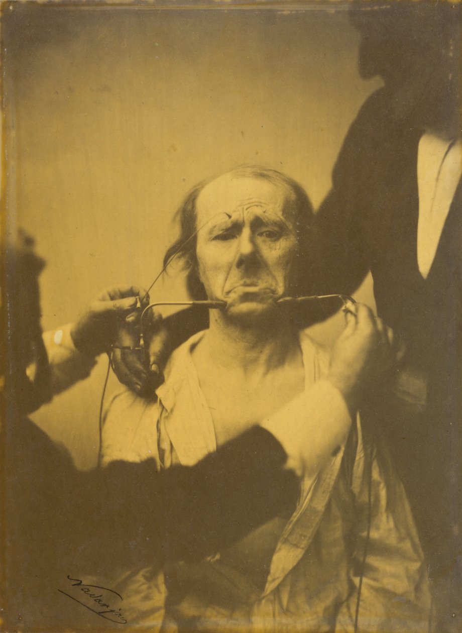Fájdalom és kétségbeesés, 1854-1856, nyomtatva 1862. alkotó: Duchenne de Boulogne