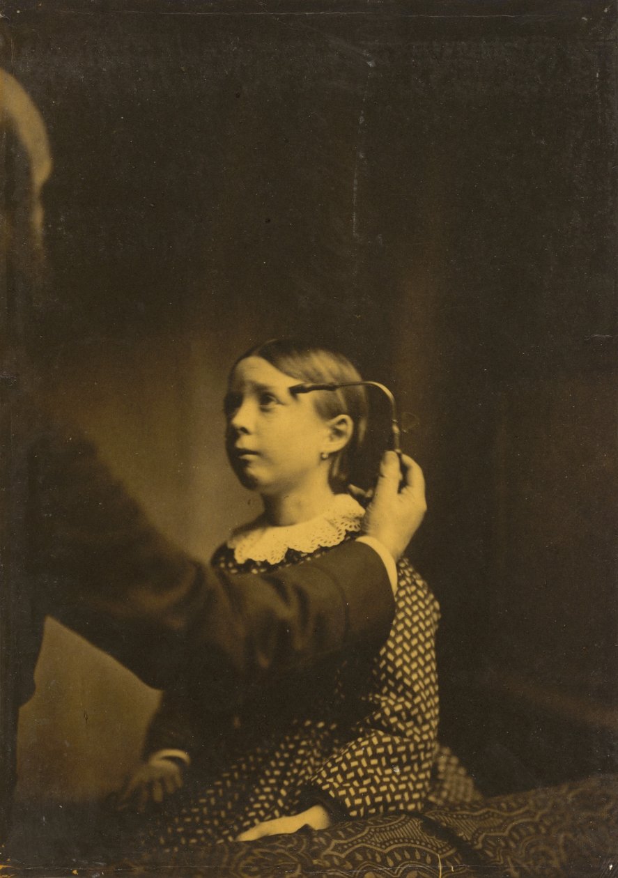 Fájdalmas emlékek, 1854-1856, nyomtatva 1862. alkotó: Duchenne de Boulogne
