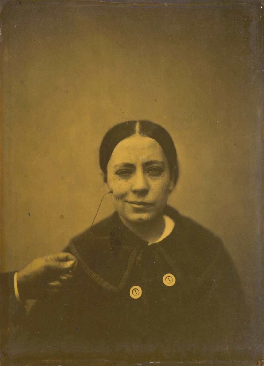 A száj szögének enyhe süllyesztése a depresszió miatt balra, hamis nevetés jobbra, 1854-185 alkotó: Duchenne de Boulogne