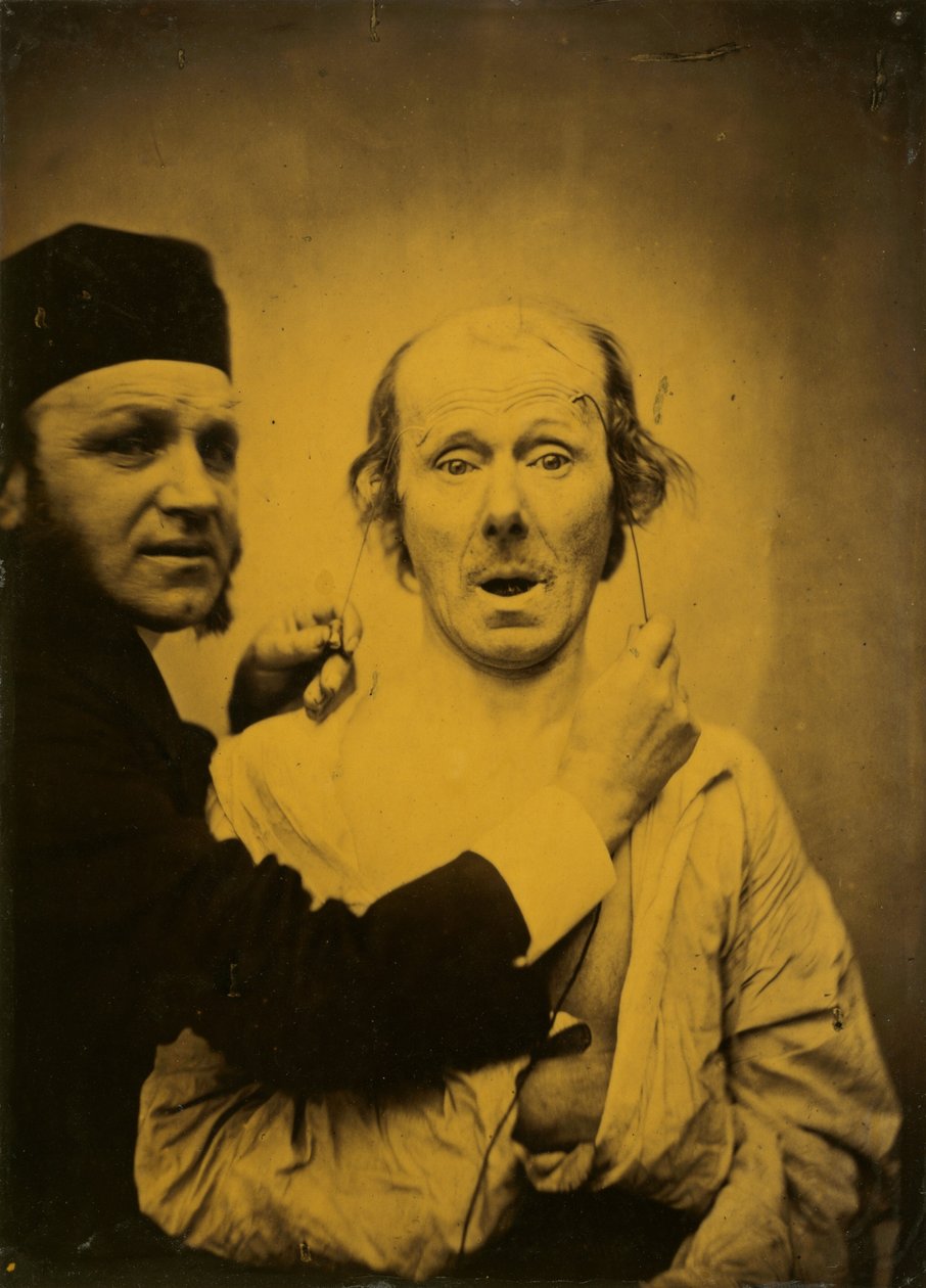 Meglepetés, 1854-1855, nyomtatva 1862. alkotó: Duchenne de Boulogne