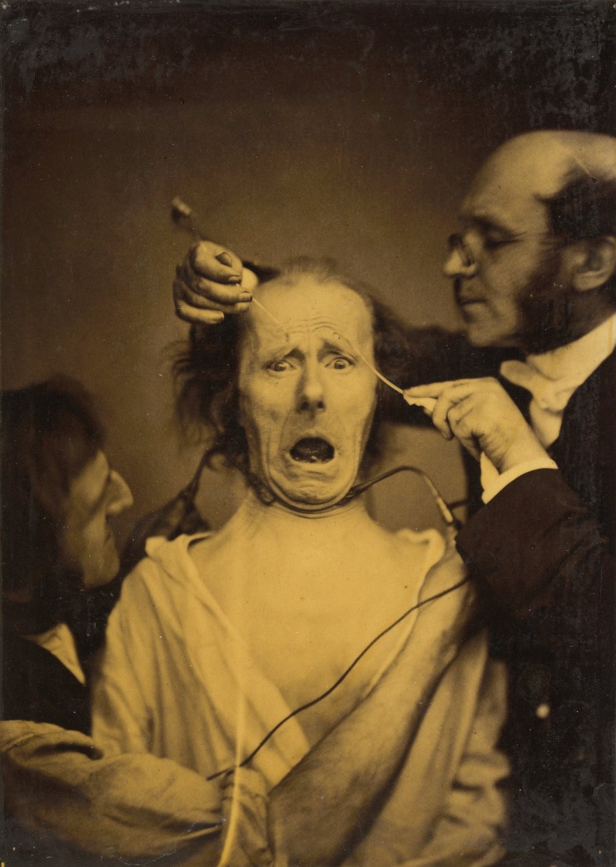 Fájdalommal kevert terror, kínzás, 1854-1856, nyomtatva 1862. alkotó: Duchenne de Boulogne