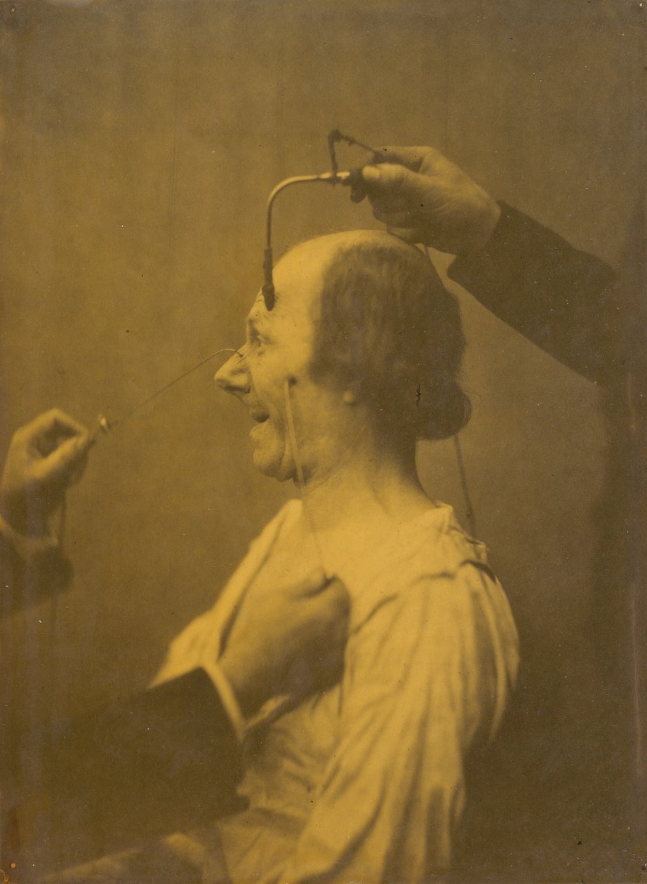 Az a figyelem, amelyet egy tárgy vonz le, amely buja ötleteket és vágyakat gerjeszt, 1854-1856. alkotó: Duchenne de Boulogne