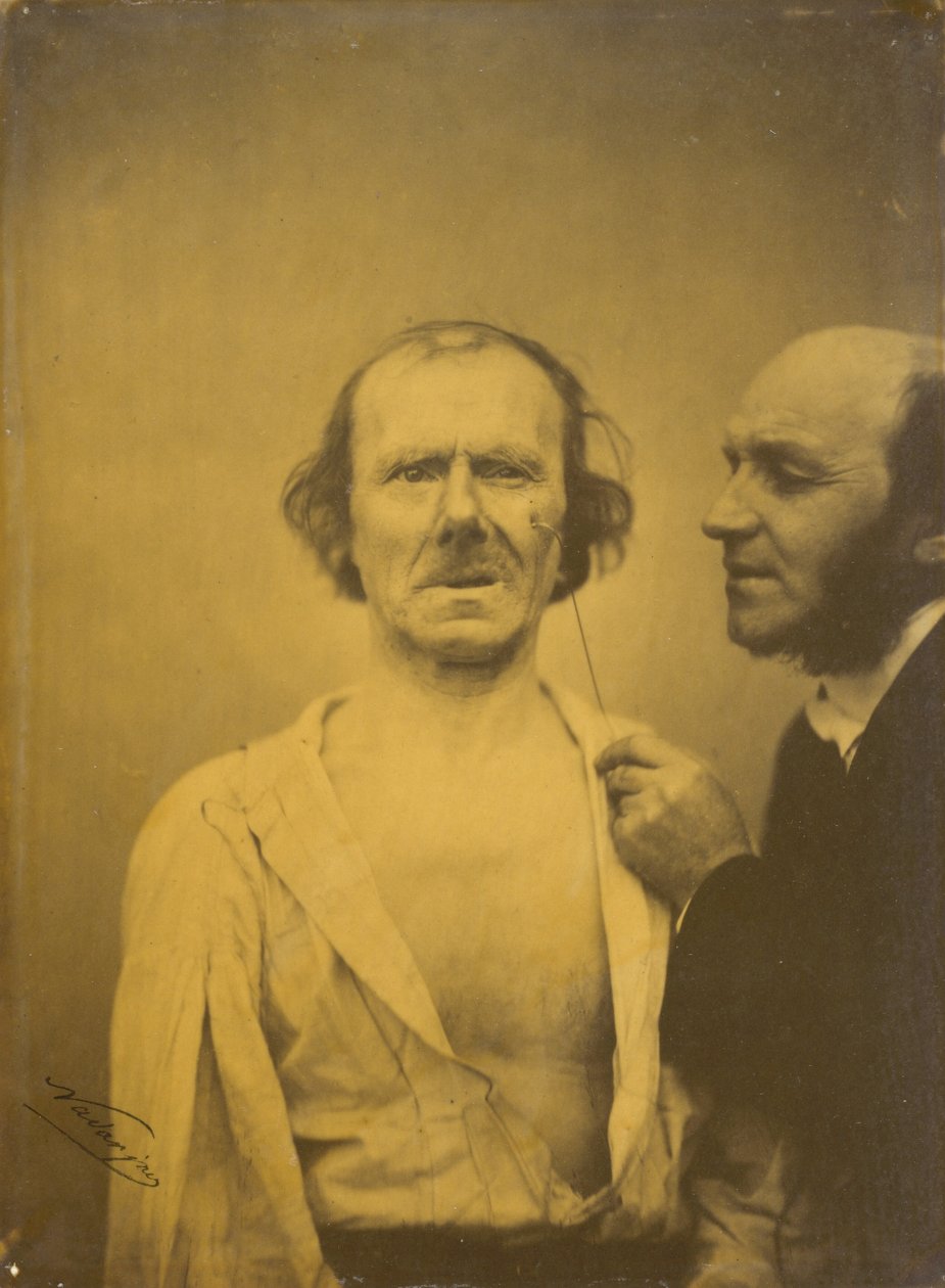 Sírás, szánalomkönnyek balra, Nyugodt arc jobbra, 1854-1856, nyomtatott 1862. alkotó: Duchenne de Boulogne
