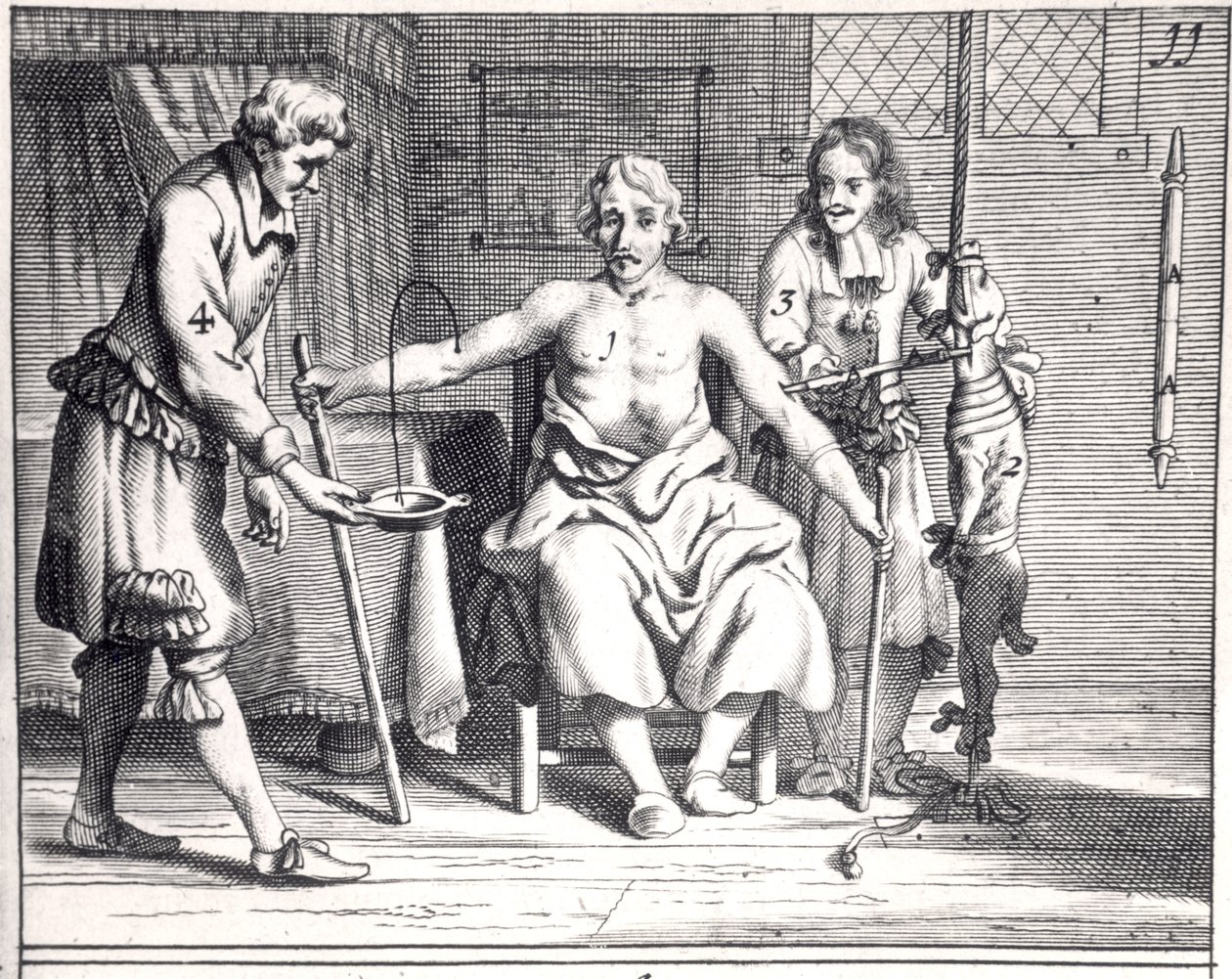 Vérátömlesztés egy kutyából, Johannes Schultes (1595-1645) Armamentarii Chirurgici könyvéből, amelyet Amszterdamban adtak ki, 1671 alkotó: Dutch School