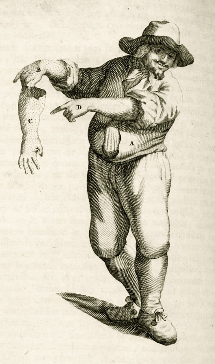 Elhalt bőr eltávolítása pustulákkal, Frederik Dekkers Gyakorlati gyakorlatai az orvosi módszerekből, 1694 alkotó: Dutch School