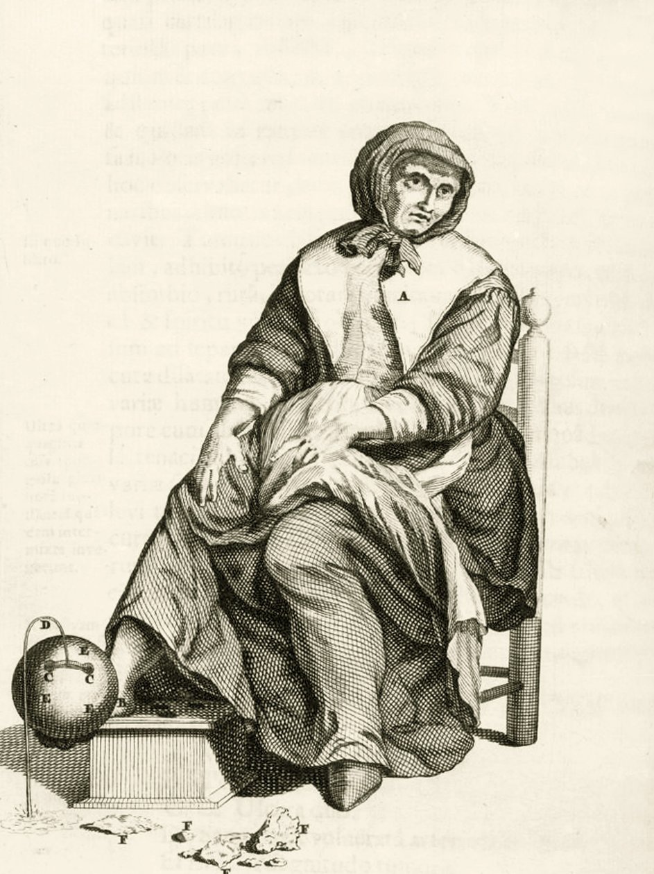 Mechanikus pióca használata, Frederik Dekkers: Gyakorlati gyakorlatok a gyógyítás módszeréről című könyvéből, 1694 alkotó: Dutch School
