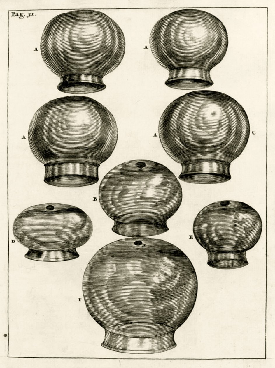 Különféle köpölyözéses poharak, Frederik Dekkers: Az orvostudomány gyakorlata, 1694 alkotó: Dutch School