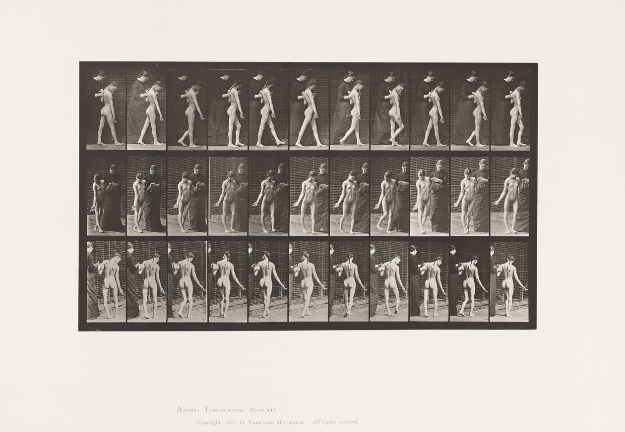 541. lemez. Cerebro-spinalis sclerosis multiplex (Choreic); Séta alkotó: Eadweard Muybridge