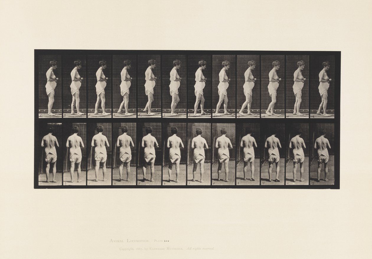 542. lemez. Cerebro-spinalis sclerosis multiplex - járás alkotó: Eadweard Muybridge