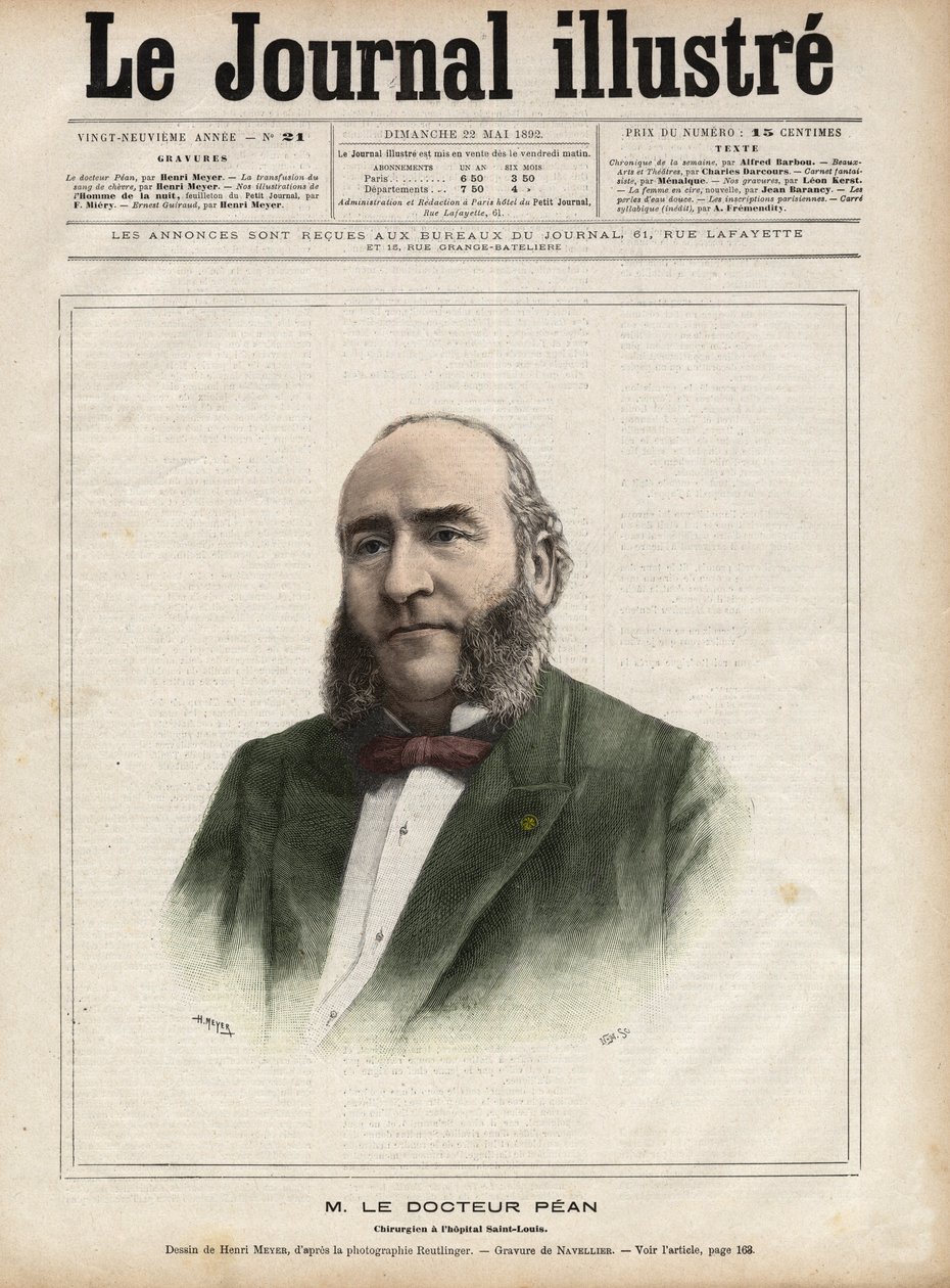 Jules Emile (Jules-Emile) Pean (1830-1898), francia sebész portréja – Navellier metszete az 1892-es „A jeles naplóban” alkotó: Edouard Felicien Eugene Navellier
