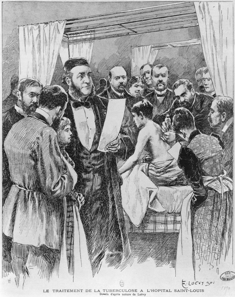 A tuberkulózis kezelése a párizsi St. Louis kórházban, 1890 alkotó: Edward Loevy