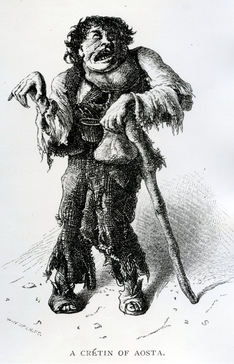 Egy aostai krétin, 1870 körül (fametszet) alkotó: Edward Whymper
