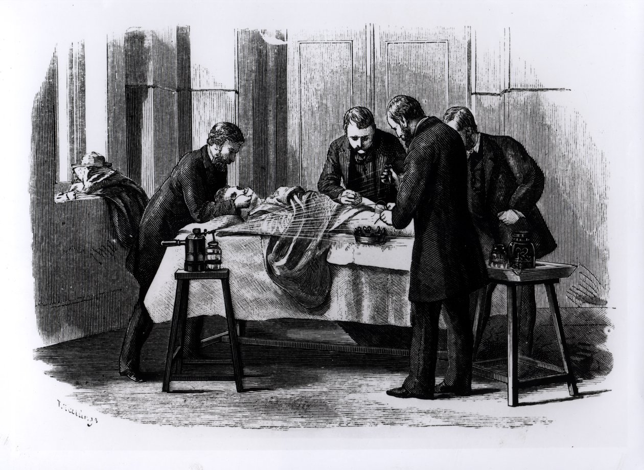 Antiszeptikus sebészet, 1882 alkotó: English School