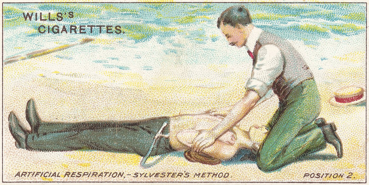 Mesterséges lélegeztetés, Sylvester módszere – 2. pozíció, 17. sz. a Wills