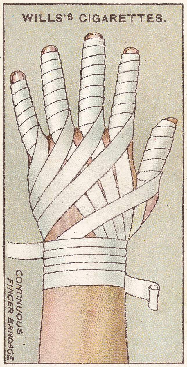 Folyamatos ujjkötés, 48. sz. a Willss Cigarettes kártya elsősegély-sorozatából, 1913 alkotó: English School