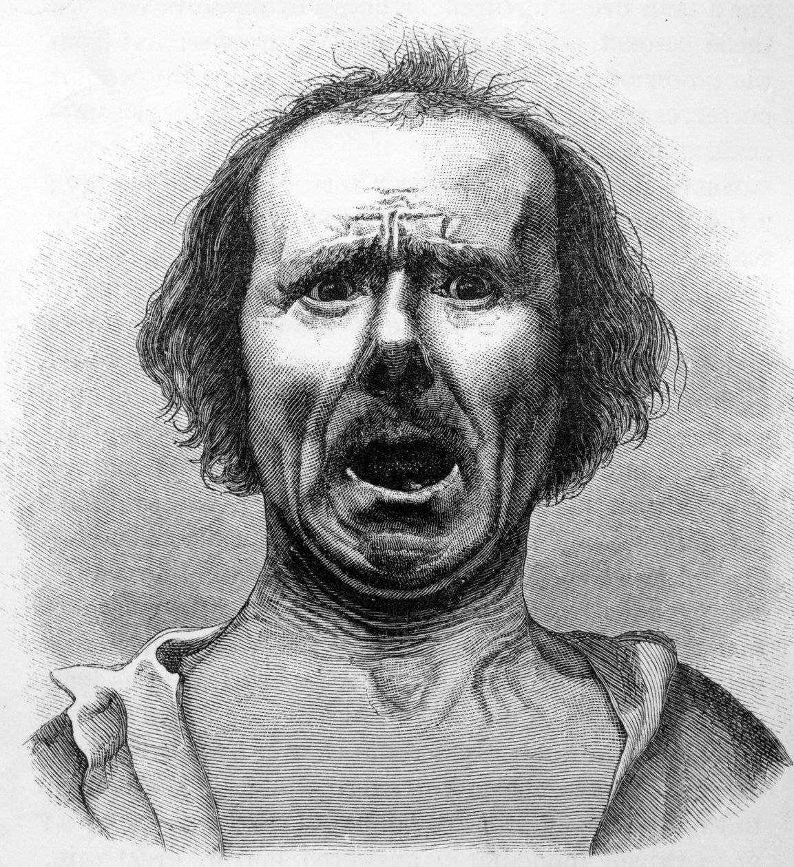 Horror and Agony, Dr. Duchenne fényképéről másolva, illusztráció Charles Darwin „Az érzelmek kifejezése az emberben és az állatokban” című művéből, 1872-ben megjelent alkotó: English School