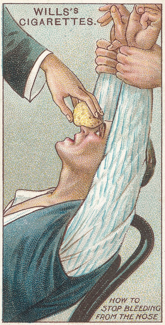 Hogyan állítsuk meg az orrvérzést, 31. szám a Willss Cigarettes elsősegély-sorozatából, 1913 alkotó: English School