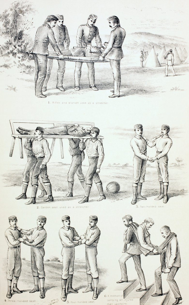 A sérültek szállításának módjai, 1890 körül alkotó: English School