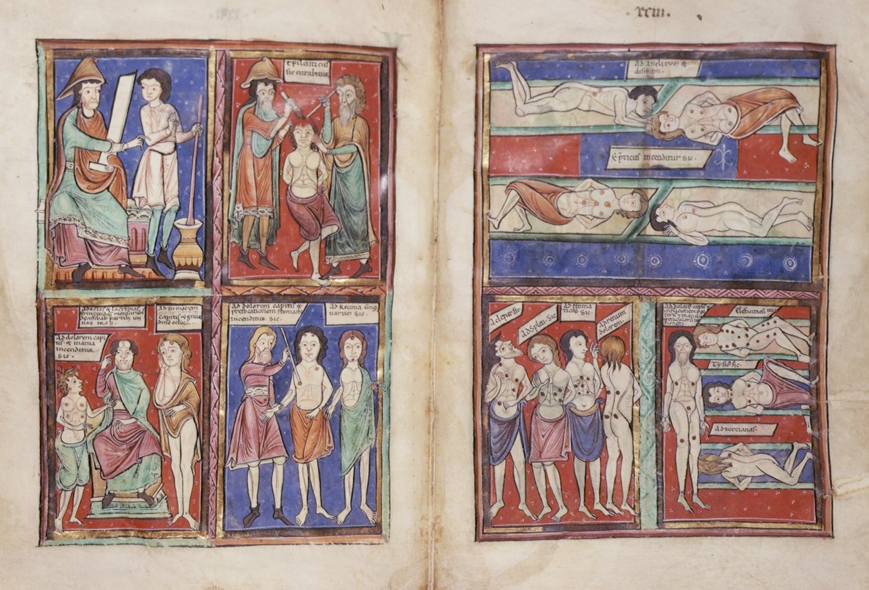 Sloane 1975 fol.91v-92 Orvosi jelenetek alkotó: English School