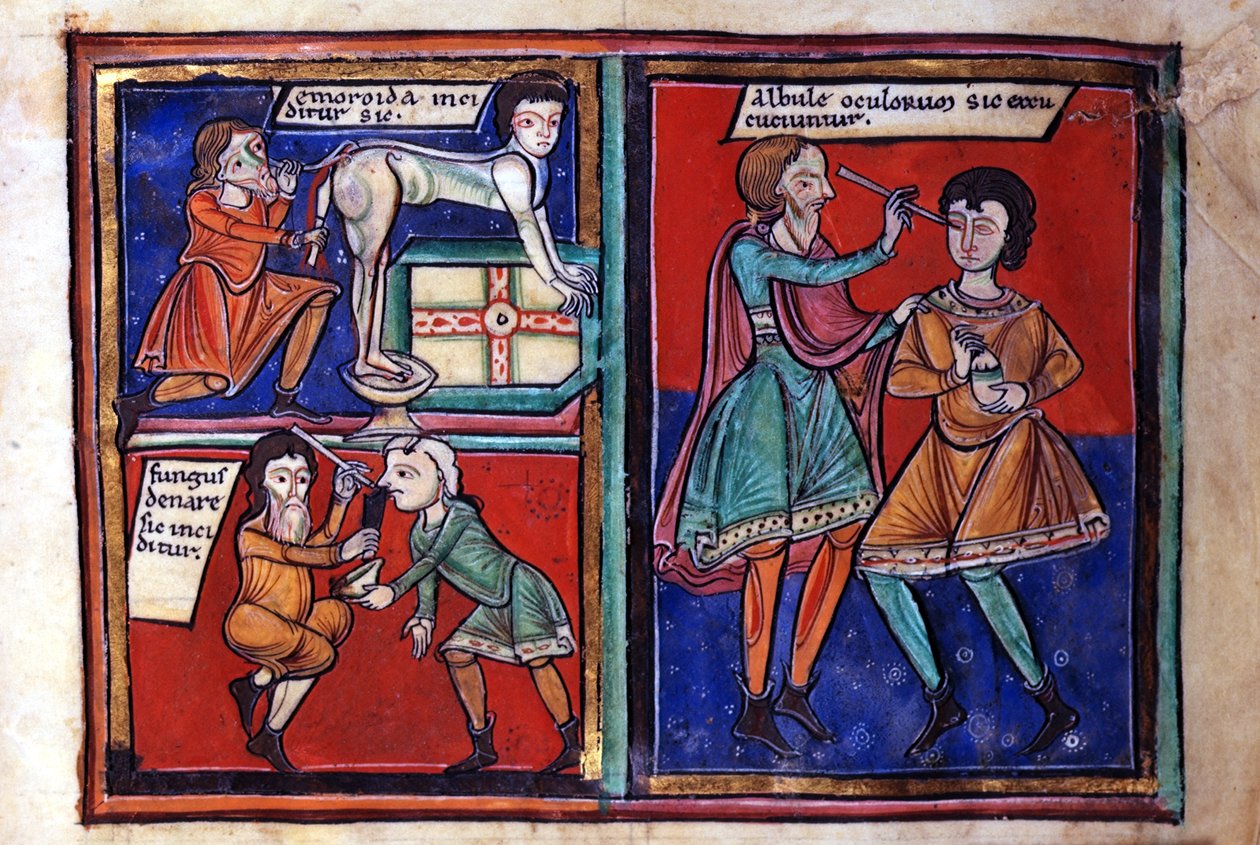 Sloane Ms 1975 fol.93 Orvosi műtétek alkotó: English School
