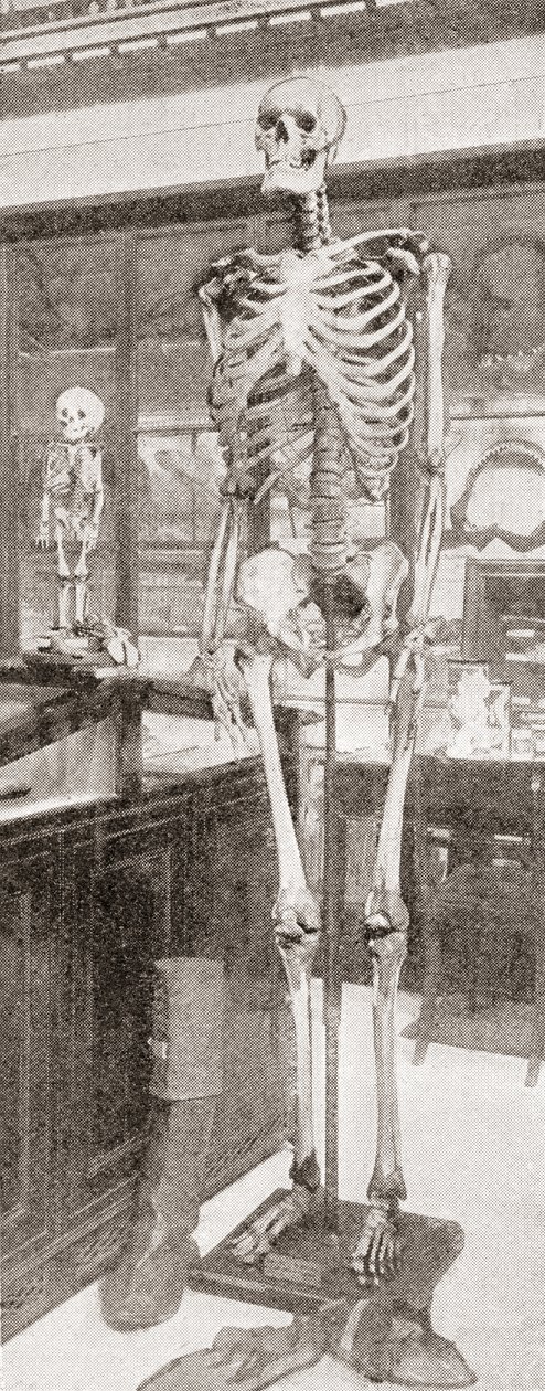 Charles Byrne csontvázai alkotó: English School